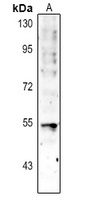 p53 Rabbit Polyclonal Antibody