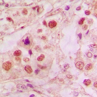 p53 Rabbit Polyclonal Antibody
