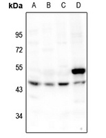 p53 Rabbit Polyclonal Antibody