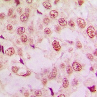 p53 Rabbit Polyclonal Antibody