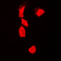 p53 Rabbit Polyclonal Antibody