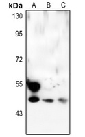 p53 Rabbit Polyclonal Antibody