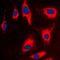 TCTP Rabbit Polyclonal Antibody