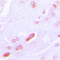 GRP94 Rabbit Polyclonal Antibody