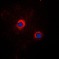 GRP94 Rabbit Polyclonal Antibody
