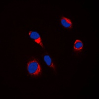 Tyrosinase Rabbit Polyclonal Antibody
