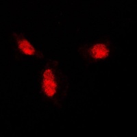 SUMO1 Antibody
