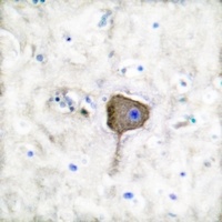 PGP9.5 Rabbit Polyclonal Antibody