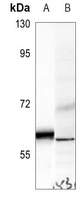 UGCG Rabbit Polyclonal Antibody