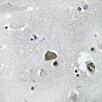 VAV2 Rabbit Polyclonal Antibody
