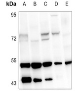 VDR Antibody