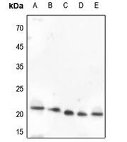 VEGFB Antibody