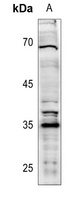 XRCC2 Rabbit Polyclonal Antibody