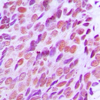 XRCC2 Rabbit Polyclonal Antibody