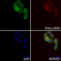 XRCC2 Rabbit Polyclonal Antibody