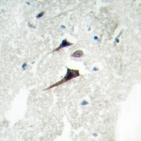 14-3-3 epsilon Antibody