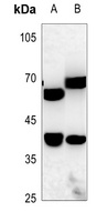 ZNF187 Rabbit Polyclonal Antibody