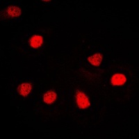ZNF187 Rabbit Polyclonal Antibody