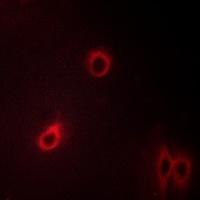 CD184 (Phospho-S339) Antibody