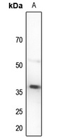 TUSC3 Rabbit Polyclonal Antibody