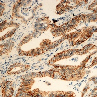 TUSC3 Rabbit Polyclonal Antibody
