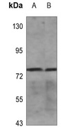 Frizzled 6 Rabbit Polyclonal Antibody