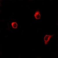 Frizzled 6 Rabbit Polyclonal Antibody