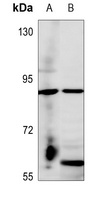 Frizzled 6 Rabbit Polyclonal Antibody