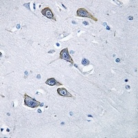 Frizzled 6 Rabbit Polyclonal Antibody