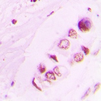 Histone H3 (Acetyl-K9) Antibody