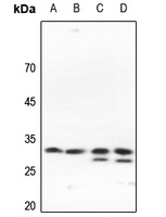 SLC25A11 Rabbit Polyclonal Antibody