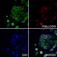 SLC25A11 Rabbit Polyclonal Antibody
