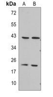 RGS5 Rabbit Polyclonal Antibody