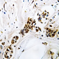 RGS5 Rabbit Polyclonal Antibody