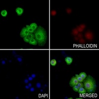RGS5 Rabbit Polyclonal Antibody