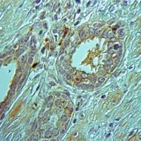 PEX3 Rabbit Polyclonal Antibody