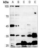 IKK gamma Rabbit Polyclonal Antibody