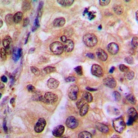 IKK gamma Rabbit Polyclonal Antibody