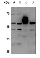 COPS3 Antibody [KO/KD Validated]