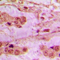 API5 Antibody