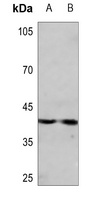 CDK10 Rabbit Polyclonal Antibody