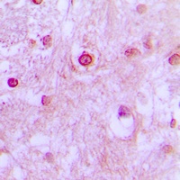 CDK10 Rabbit Polyclonal Antibody