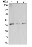 B3GALT4 Rabbit Polyclonal Antibody