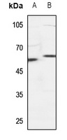 SNX4 Rabbit Polyclonal Antibody