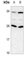 RAIDD Rabbit Polyclonal Antibody