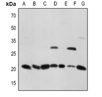 CD256 Antibody