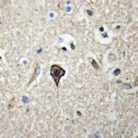 TWEAK Antibody