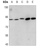 ADAM23 Rabbit Polyclonal Antibody