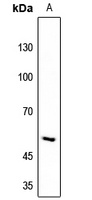 RIOK3 Rabbit Polyclonal Antibody