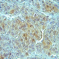 RIOK3 Rabbit Polyclonal Antibody
